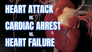 Cardiac Arrest vs. Heart Attack vs. Heart Failure