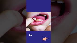 Can kids wiggle their loose tooth?