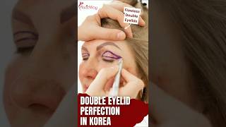 Enhance Your Beauty with Double Eyelid Surgery in South Korea – Safe, Natural Results with Placidway