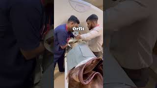 What Radiation oncologist does ? #ytviral #ytshorts #ytshortsindia #ytshortsvideo #yt  #radiation