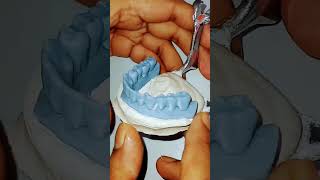 #dentist #dental #dentalbraces #satisfying #dentalwork #dentalcare #implant #dentalworld #dentaltrea