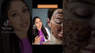 3 Reasons your Hyperpigmentation isn't fading. #doctorv #skincare #Hyperpigmentation #skin of colour
