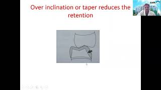 STRUCTURAL DURABILITY|DEPARTMENT OF PROSTHODONTICS|Dr. PRASAD ARAVIND