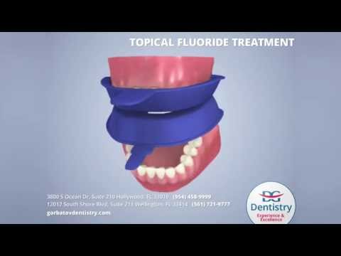 Fluoride Treatment