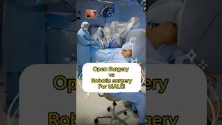 Breaking down the difference between open vs robotic surgery for MALS! #roboticsurgeon #surgeonlife