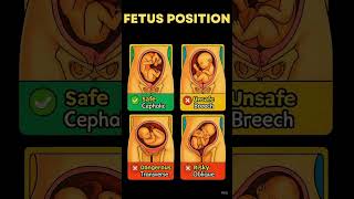 Fetal Positions Explained 👶 | Safe vs Risky Pregnancy Positions