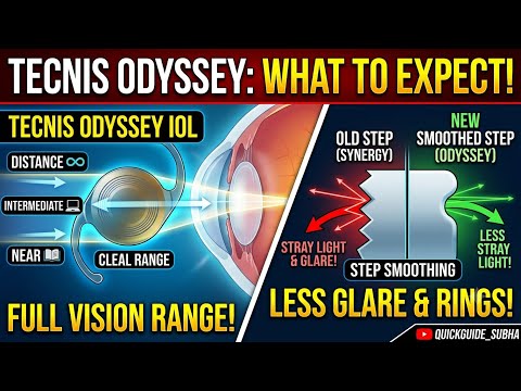 Tecnis Odyssey IOL-  What to expect