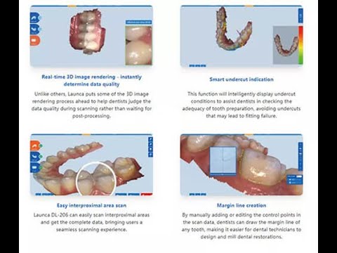 How does a digital #intraoral scanner works?-Shenzhen Beston,digital impression scanners supplier
