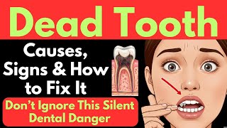 Dead Tooth | Dead Tooth Nerves | Dead Tooth Symptoms | Dead Tooth Treatment | Dead Tooth No Pain