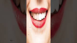 Shine your teeth | #shorts #lifestyle #lifehacks #lifehack #trendingshorts #trending #lifehackvideo