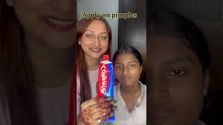 Diy pimple Hack✨ #youtube #diy #hacks #trending #trendingshorts #viral #ytshortsviral #viralhacks