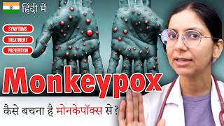 What is Monkeypox? [Monkeypox Virus] | Dr. Richa Tiwari