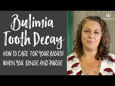 Bulimia Tooth Decay - Take Care of your Mouth when you are Binging and Purging