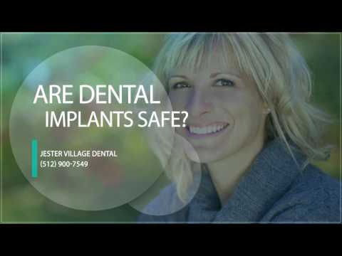 Dental Implants - FAQ - Austin, TX