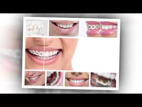 Crowns | Redding, CA – Moore & Pascarella Dental Group