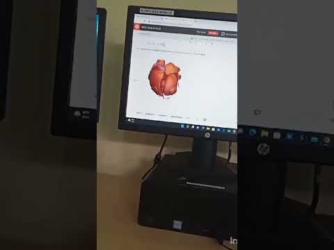 Wolfram heart
