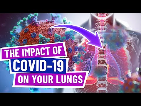 HOW COVID-19 IMPACTS YOUR LUNGS- A PICTORIAL/IMAGING REVIEW