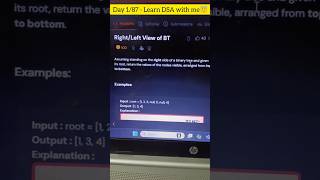 Day 1/87 DSA with me- Right/Left view of Binary Tree#aishu#dsa#coding#interviews#easy#education#acc