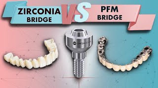 Why do we need sleeves in screw retained restoration on Multi units? Bigger screw channels risk