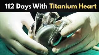 The Historic Fake Heart Surgery | Tech Evolution