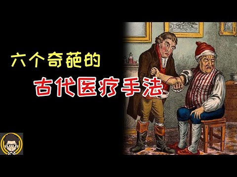 你不知道的6个奇葩古代醫療手法
