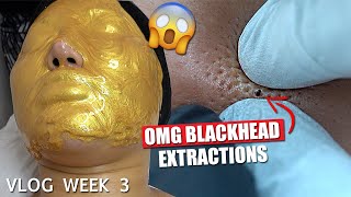 CRAZY BEAUTY TREATMENTS BLOGGERS GET DONE *TALKING ABOUT MY REGRETS* || VLOG WEEK 3