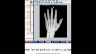 Fingerprint Image Quality Assessment for Fake Biometric Detection Application to Iris-Fingerprint