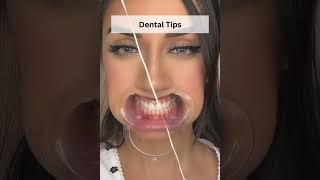 Essential Dental Care Tips for a Healthy Smile! #DentalCare #OralHealth #HealthySmile #TeethCare