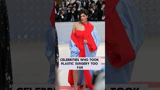 Celebrities Who Took Plastic Surgery Too Fa