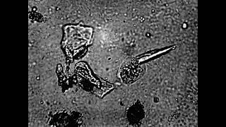 Protists and Micro-animals in a Weird State of Stasis