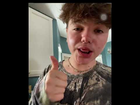 STATIC #influencer #skincare #lipsyncs  #viralvideo #viral #fypシ゚viral