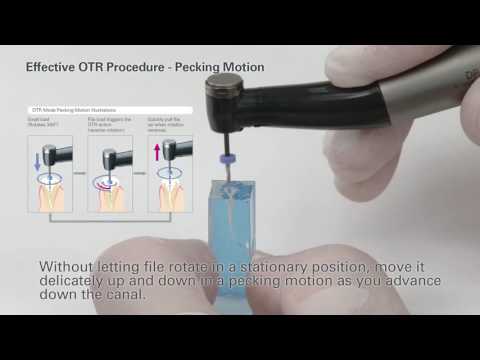 How to Use Root ZX II OTR Module