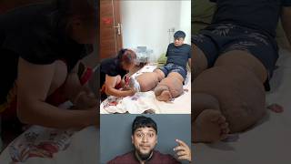 Mother Taking Care of His Disable Son#shorts#disabled#viralshorts#shortsfeed
