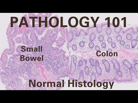 Normal Histology of Small Bowel and Colon | Pathology 101| GI Pathology