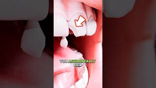 Chipped a Tooth? Watch How Dentists Fix It Instantly!