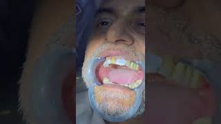 Dad needs a smile makeover #dentistinchennai