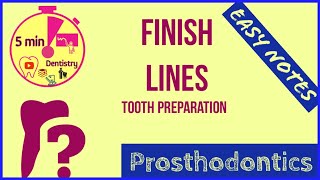 FINISH LINES - TOOTH PREPARATION - FPD - easy notes