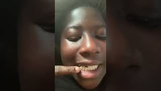 Braces guy help