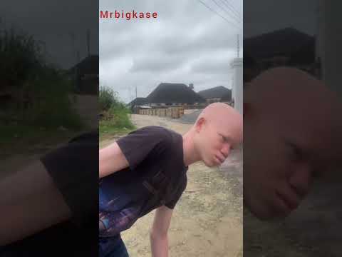Another Wahala for albino