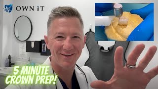 5 Minute Crown Prep (FREE)