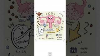 Struggling with PCOS? Here's what no one tells you. 💥#PCOSAwareness #PCOS  #PCOSWarrior #PCOSSupport