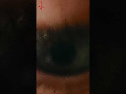 Eyeball edit