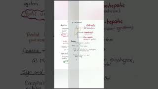 portal hypertension #simplenursing #easynotes #shortnotes #medicalnotes