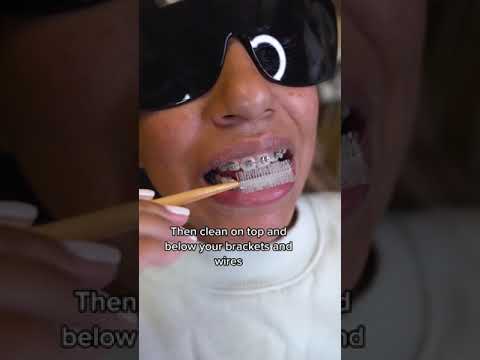 #thedontist reviews Ortho-buddy #toothbrush for #braces .. #Shorts