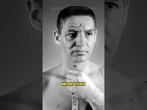 400 Stitches. No Mask. One Legend