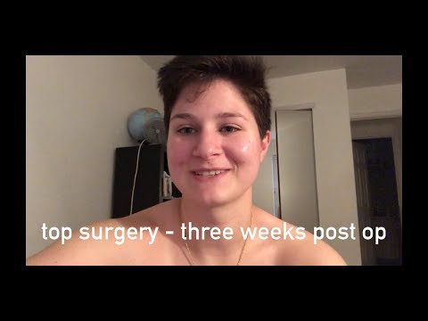 3 weeks post op top surgery - nb|tm