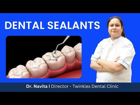 Cost of Dental Sealants? I Dental sealants vs Dental fillings I Side Effects  OF Dental Sealants