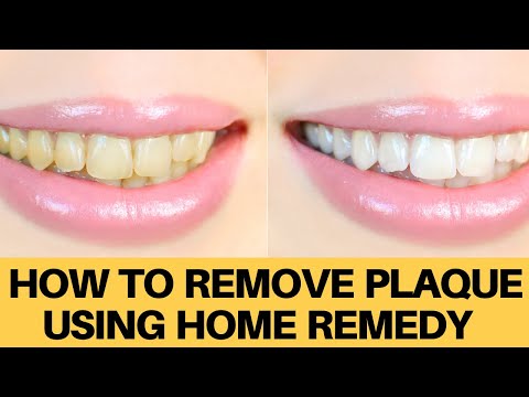 How to remove tartar or plaque using home remedy