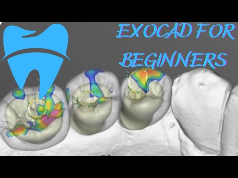Fastest Exocad Video Tutorial - Screw Retained Reduced Crowns