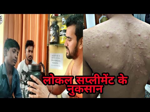 लोकल सप्लीमेंट के नुकसान local supplement side effect